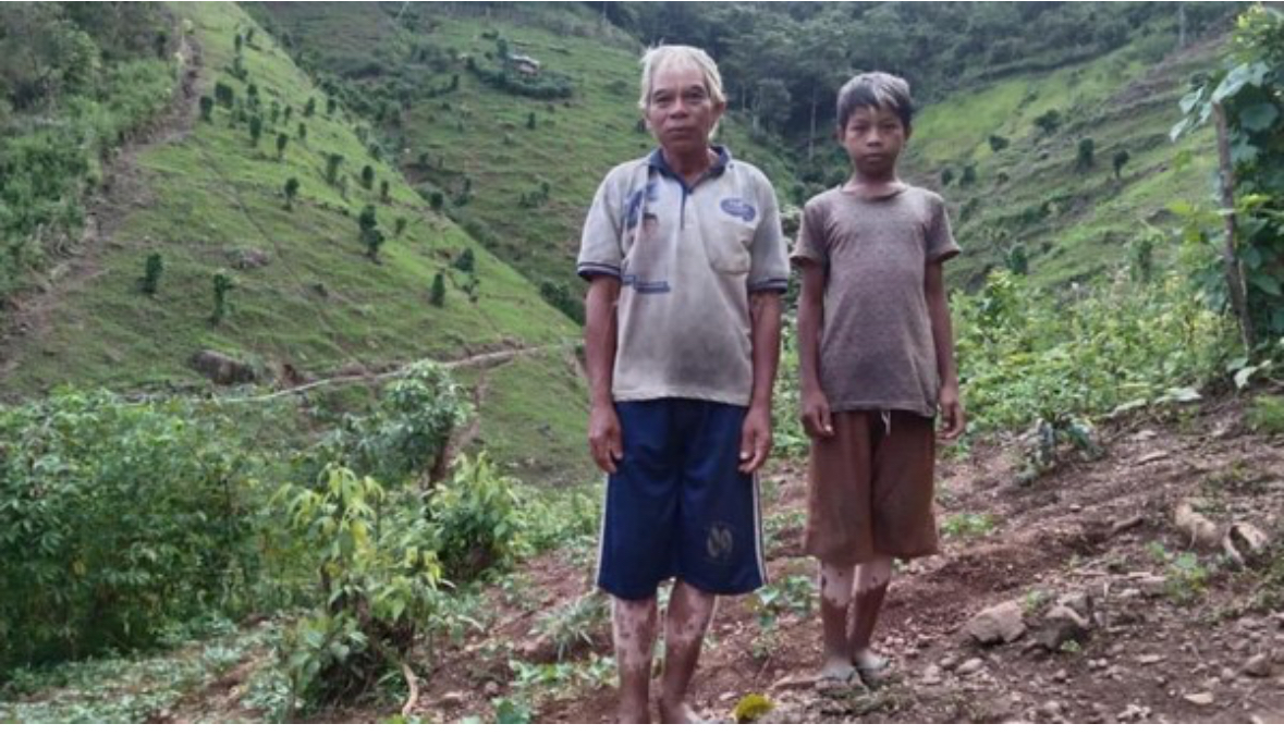Mengenal Suku Tobalo: Etnis Unik Berkulit Belang di Barru, Sulawesi Selatan