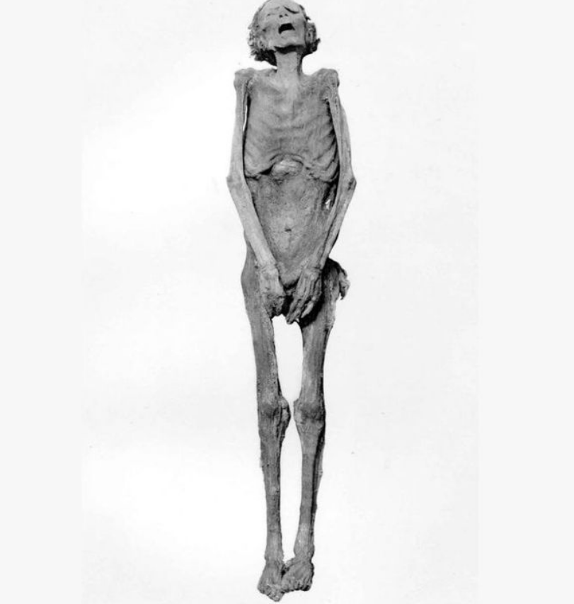 Ada mumi lain yang dikuburkan di samping Ramses III. Mumi tersebut lebih kecil dengan wajah yang terdistorsi dan tampak menjerit.