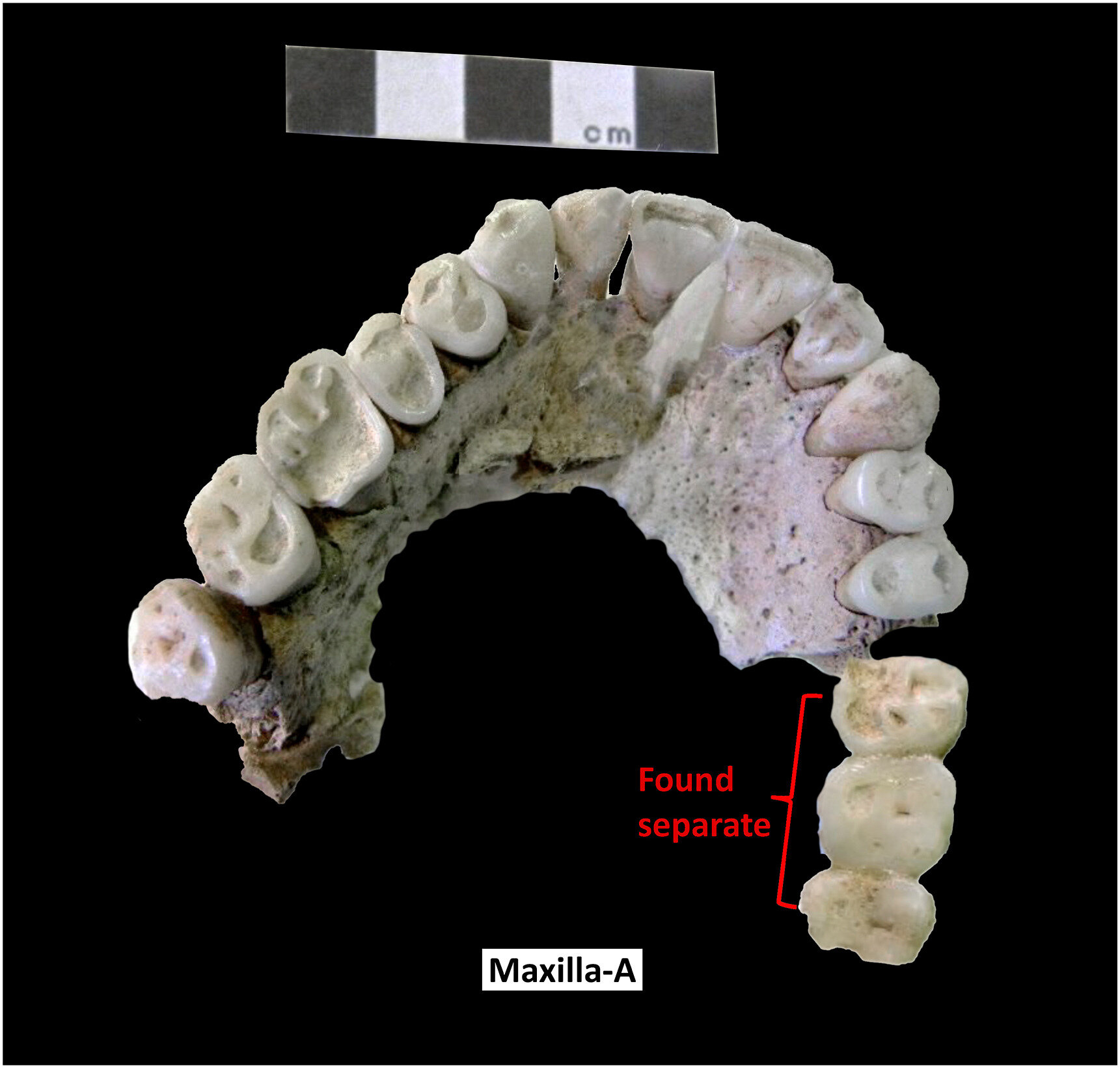 Maxilla-A (DEM-3233,3410) (tampilan bawah) milik individu yang sama dengan mandibula-A. Sekelompok tiga gigi (geraham kiri 1,2,3) ditemukan terpisah tetapi berartikulasi dengan yang lain.
