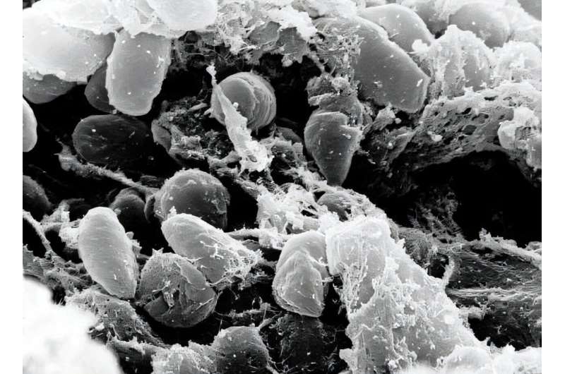 Sebuah mikrograf mikroskop elektron pemindaian yang menggambarkan massa bakteri Yersinia pestis di usus depan kutu yang terinfeksi.