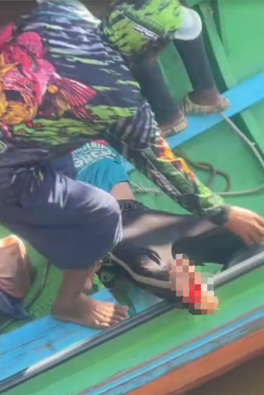 KAMARUDDIN UNTUK RADAR TARAKAN DITERKAM BUAYA: Insiden warga Mamolo diterkam buaya terjadi lagi dan kembali menimpa pembudidaya rumput laut, beruntung korban masih selamat  &nbsp;