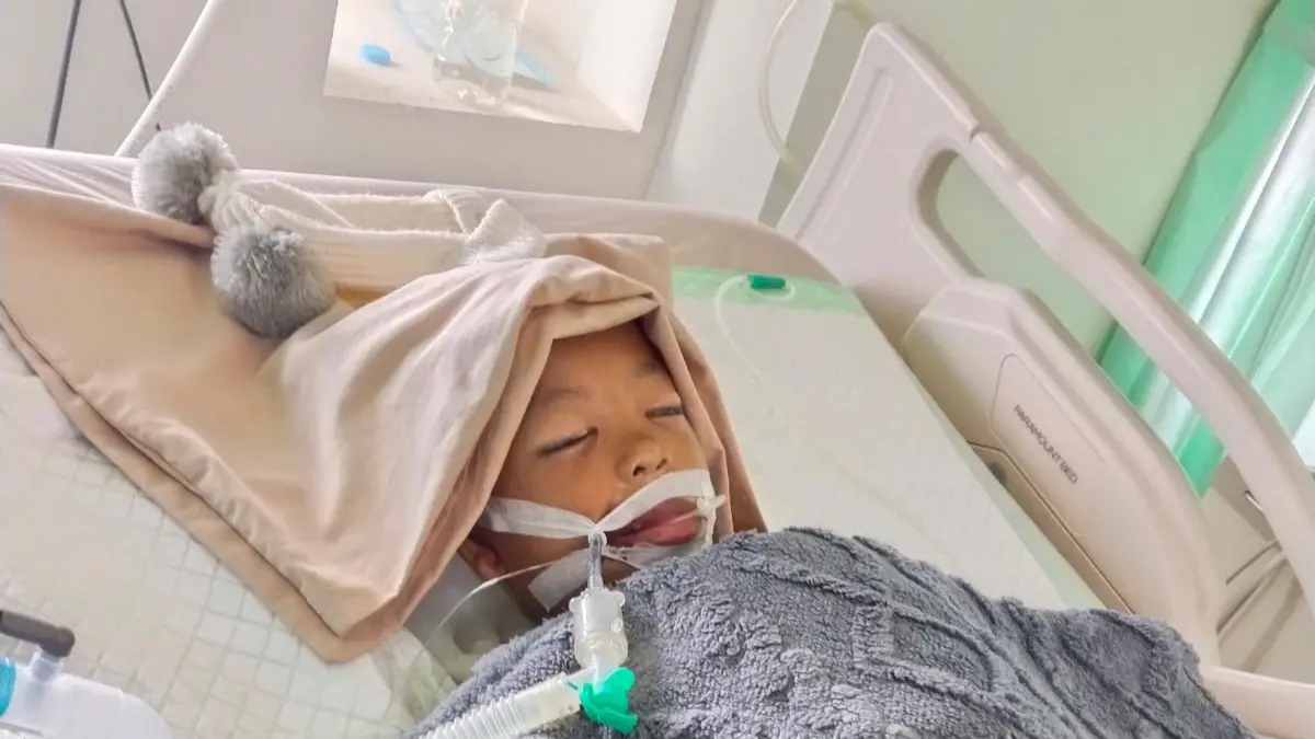 Kondisi Zivian alias Ade (5), yang masih menjalani perawatan intensif dan membutuhkan operasi ke luar Kota Tarakan. FOTO: AGUS DIAN ZAKARIA/RADAR TARAKAN