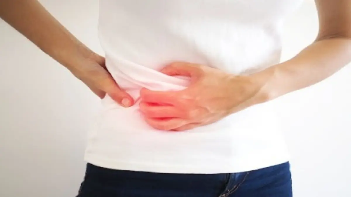 Ilustrasi Hernia.