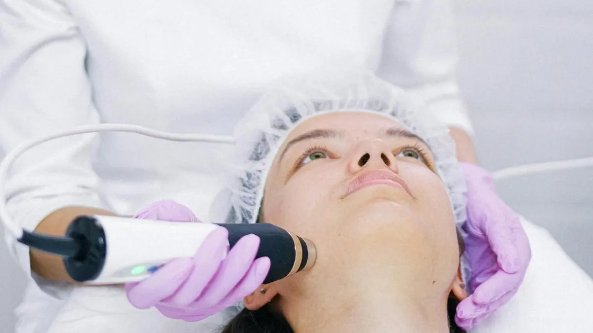 Over Treatment memperparah kondisi melasma.