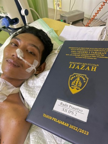 TERBARING: Radit Prasetyo, seorang pemuda yang menderita penyakit langka di Tarakan. FOTO: AGUS DIAN ZAKARIA/RADAR TARAKAN