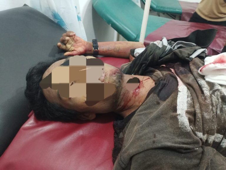 Jenazah korban saat berada di Puskesmas Pagurawan.