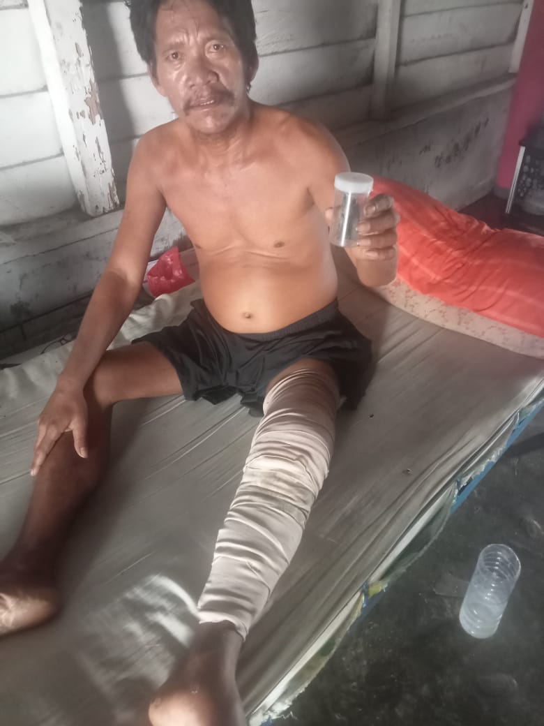 Korban dugaan malprektek dokter di Tanah Jawa.