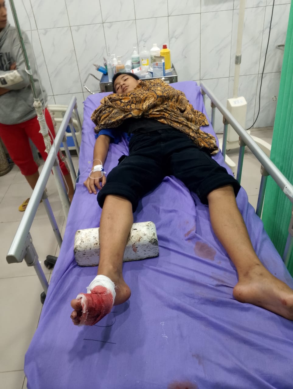 Remaja dibacok di Tapteng hingga jarinya nyaris putus.