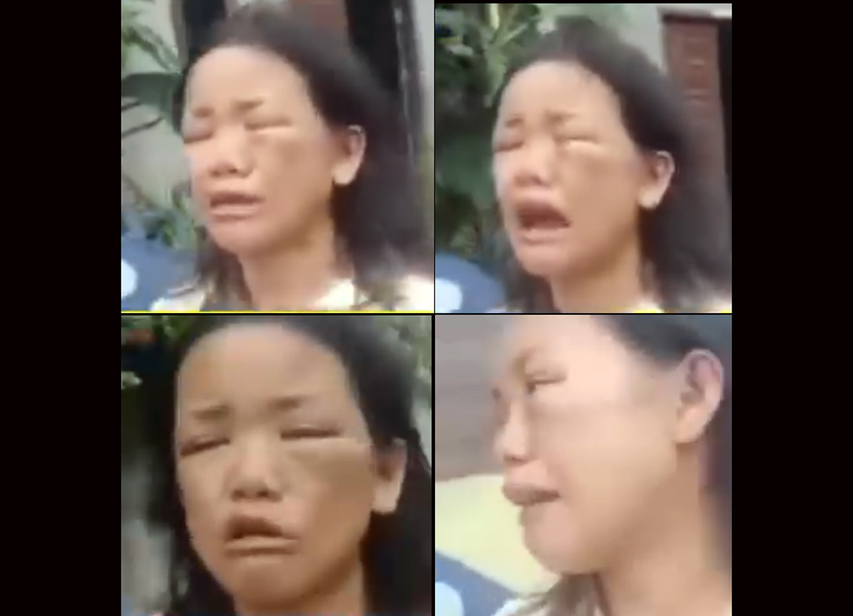 Istri dianiaya suami hingga 12 jam.