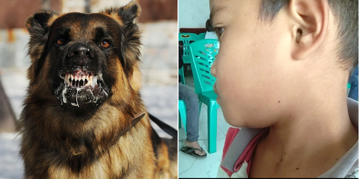 Anjing gila (ilustrasi), dan salahsatu anak yang digigit.