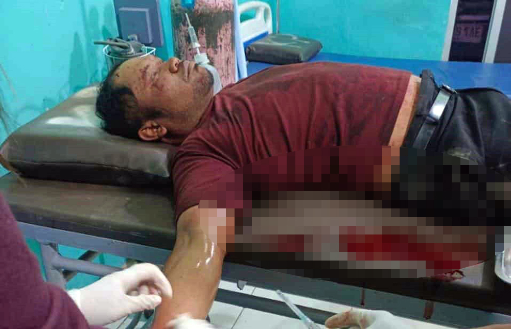 Korban pembacokan, Victor Haloho, saat mendapat perawatan medis akibat luka tikam di tangan dan leher usai diserang tetangganya.