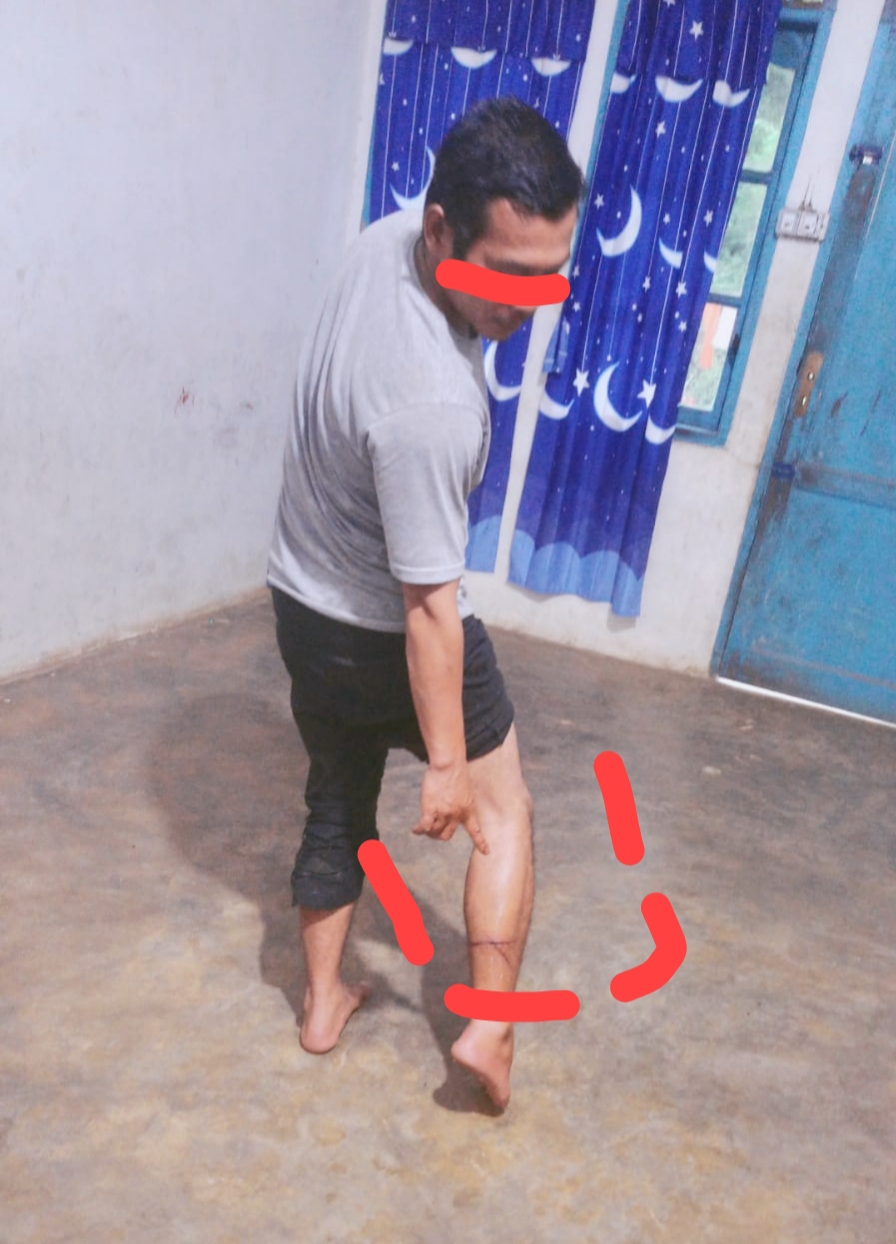 Pria bernama A.T (35), warga Desa Muliarayat, Kecamatan Merek, disabet celurit oleh pelaku penyerangan hanya karena memegang ponsel saat melintas di lokasi kejadian.