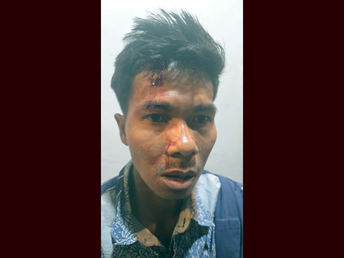 Mahyudin (31), korban dugaan penganiayaan di Desa Tongging, Kabupaten Karo, saat menjalani perawatan di RSUD Kabanjahe.