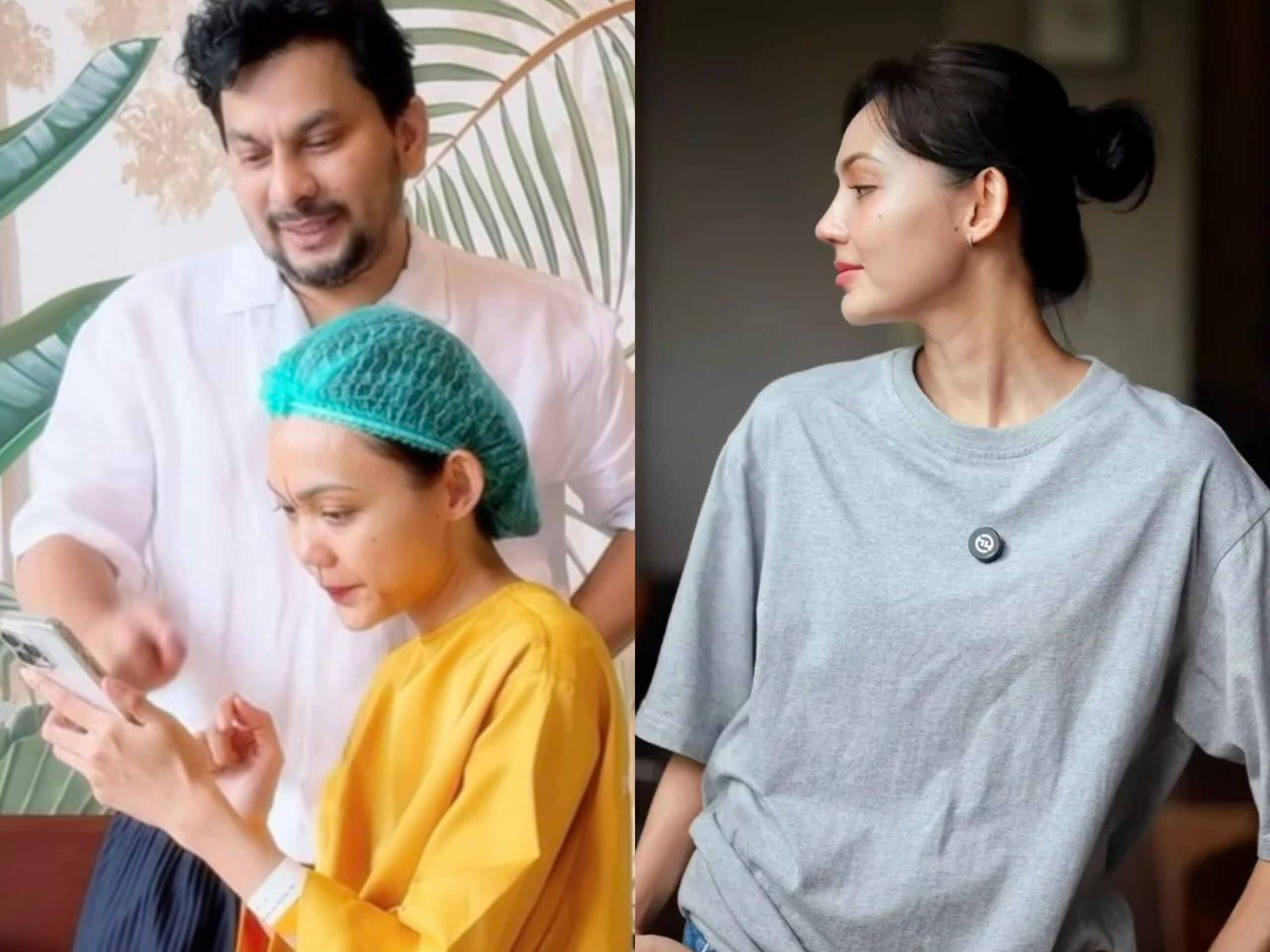Rina Nose menjalani operasi hidung di klinik dokter Tompi di Bintaro sebagai bagian dari perawatan estetika wajah dan peremajaan diri.