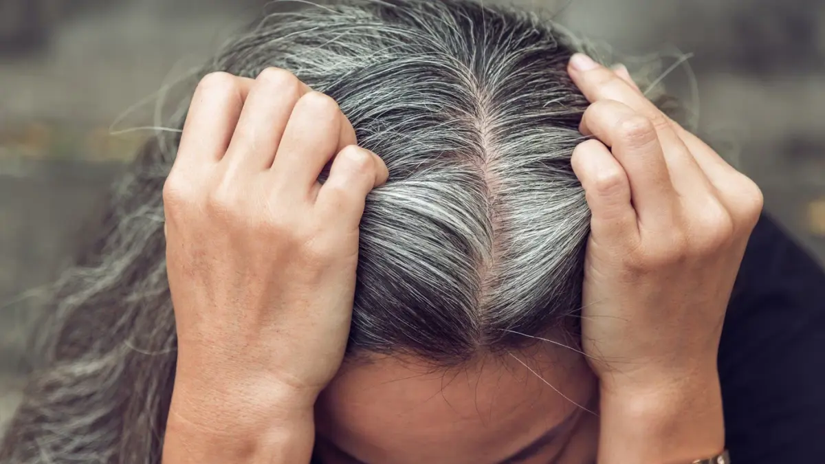 Ilustrasi rambut beruban yang dipicu stres dan kekurangan nutrisi, berdasarkan temuan studi ilmiah terbaru.