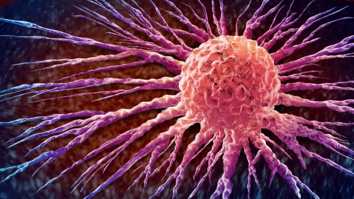 Ilustrasi sel kanker payudara dan analisis AI pada jaringan tumor yang digunakan untuk memprediksi manfaat kemoterapi.