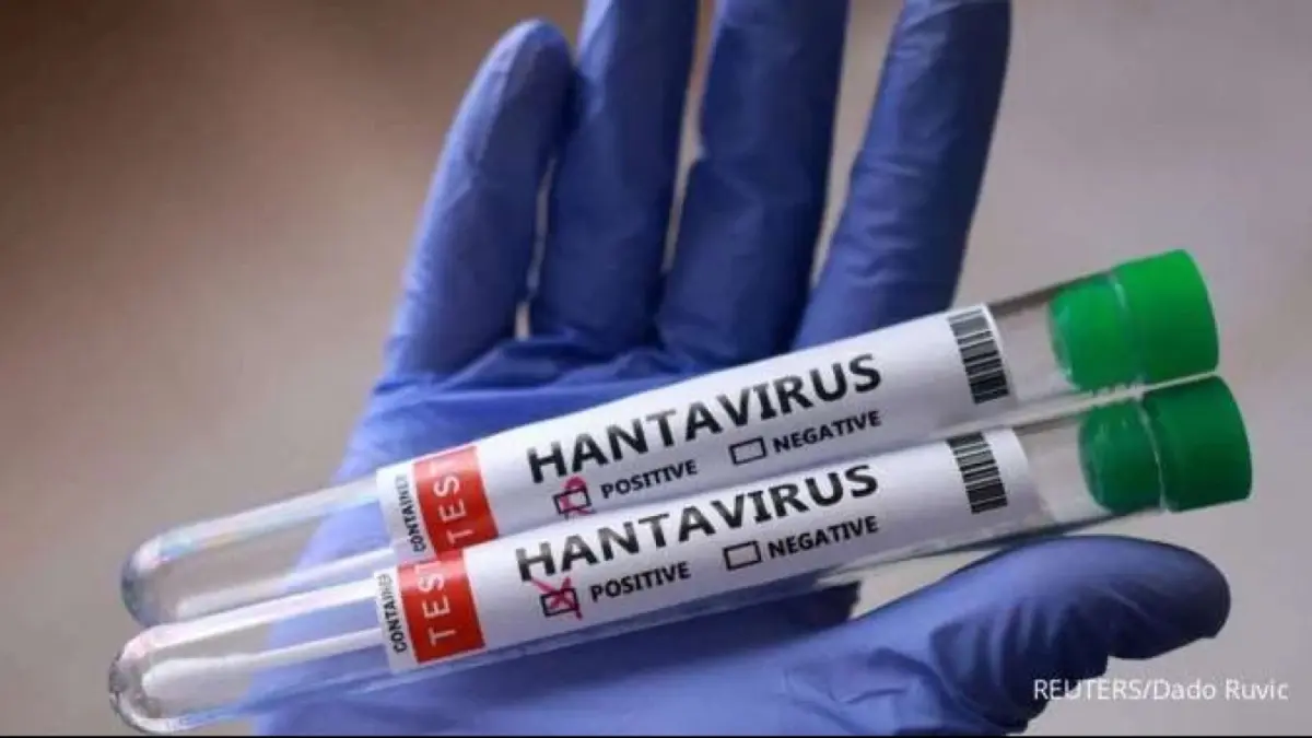 Sekretaris Dinas Kesehatan Sumut Hamid Rizal mengimbau masyarakat meningkatkan kewaspadaan terhadap potensi penyebaran Hantavirus di Sumatera Utara.