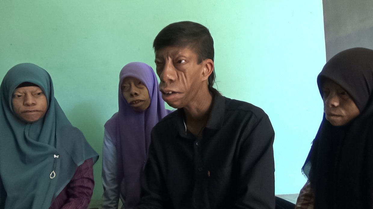 Foto: Perdana Ramadhan / Metro Asahan  Surya Manurung bersama dua saudara kandungnya saat ditemui di rumah mereka. 