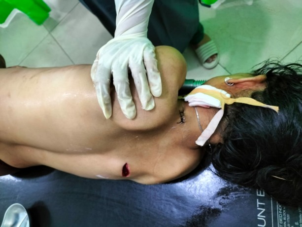 Seorang wanita paruh baya tewas dengan luka tusuk di bagian punggung, di belakang PD Pasar Horas Jaya Kota PematangSiantar, Sumatera Utara, Kamis (26/5/22) malam.