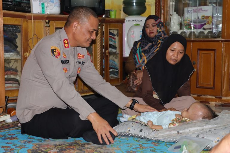 Kapolres Asahan AKBP Rocky H Marpaung menjenguk Raihan Hafidzah. (Foto: Humas Polres)