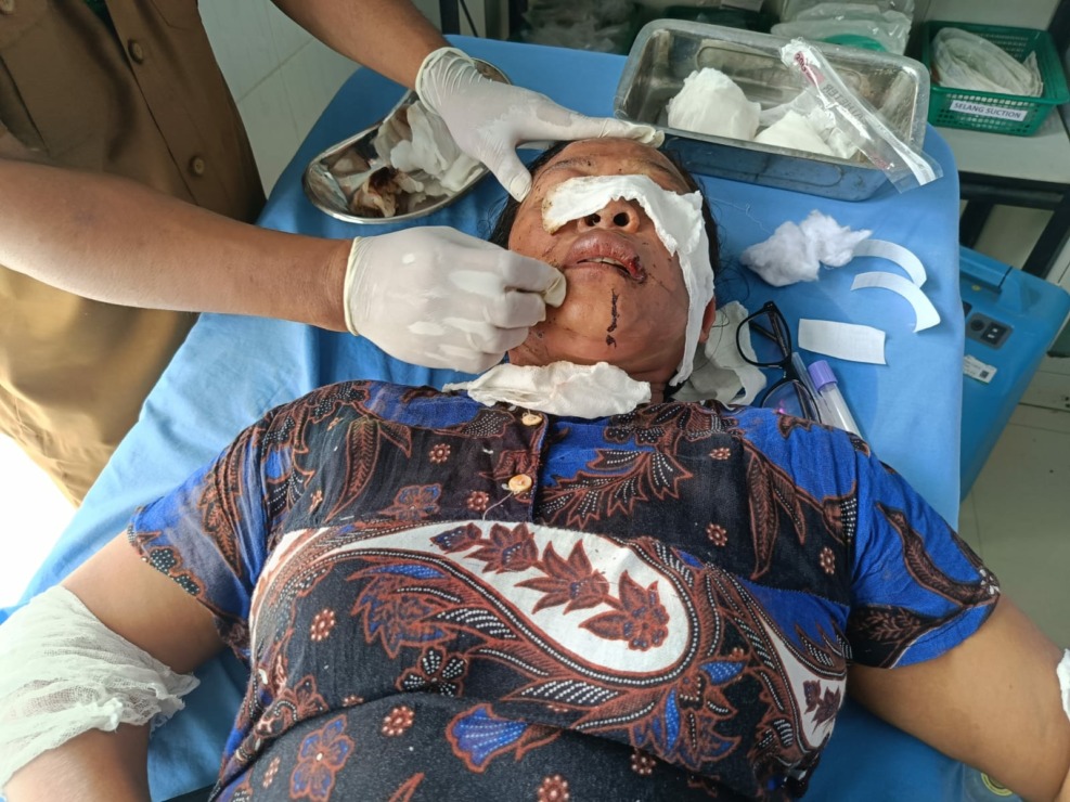 Korban saat mendapat perawatan pada wajah dan tangannya, Selasa (9/5/2023) di IGD RSUD Panyabungan, Madina. (Foto: Samman/MetroDaily)