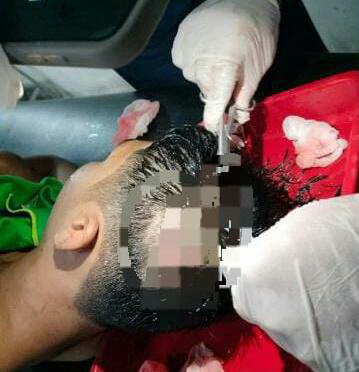 Korban saat mendapat perawatan oleh tim medis rumah sakit.