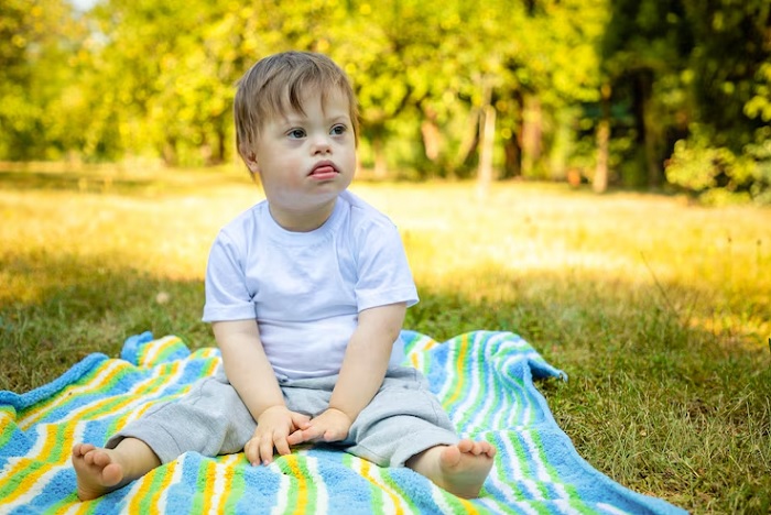 Ilustrasi anak laki-laki dengan down syndrome.
