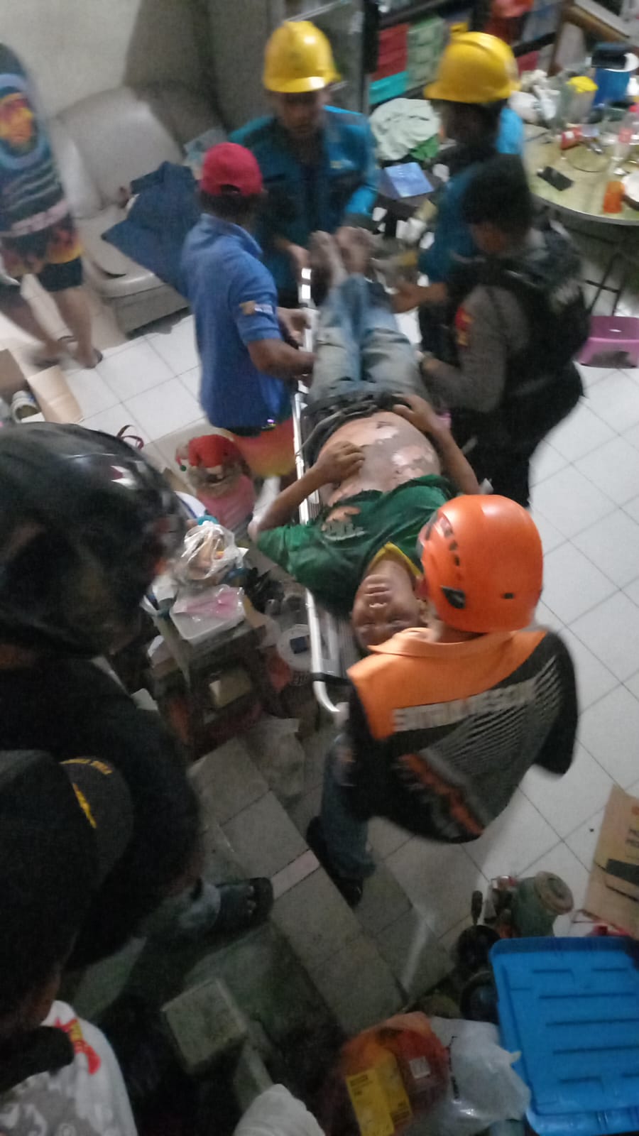 PEKERJA: Di sengat listrik dan mengalami luka cukup serius. Hampir sekujur tubuhnya mengelupas. (Foto/IST)