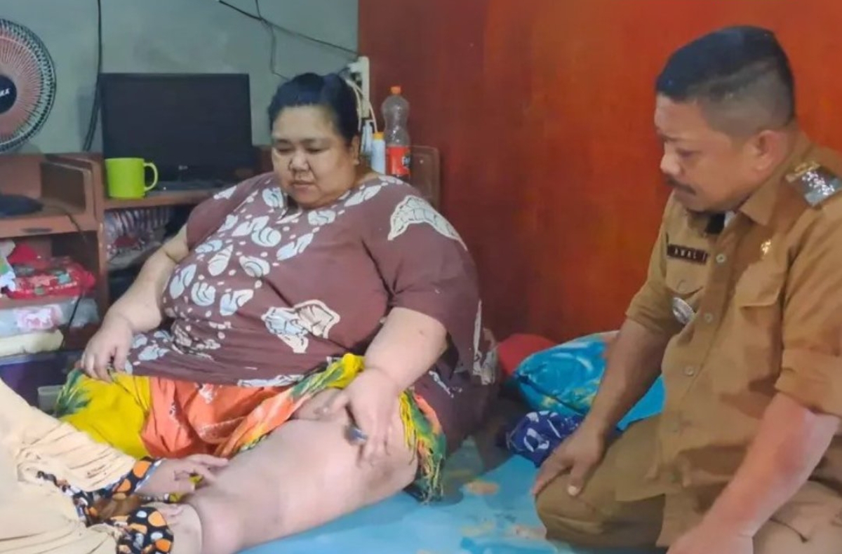 KESULITAN: Sejak bobot Jumriah menembus 200 kg, kini sehari-hari hanya bisa duduk dan merangkak atau ngesot ketika mau berpindah tempat. (FOTO: IST)