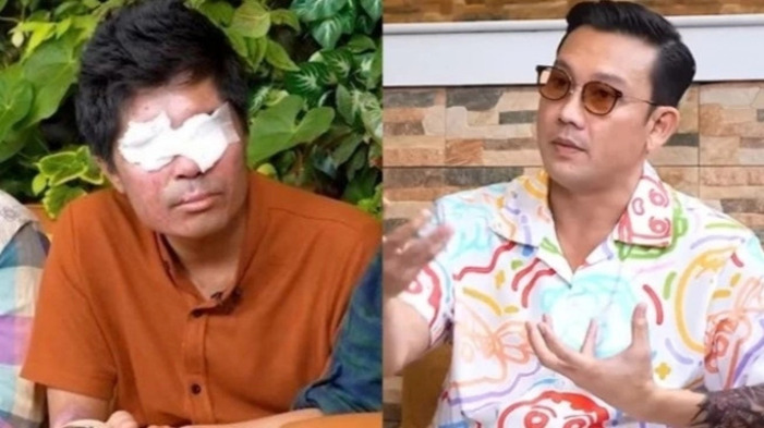 Babak baru Agus Salim, korban penyiraman air keras.