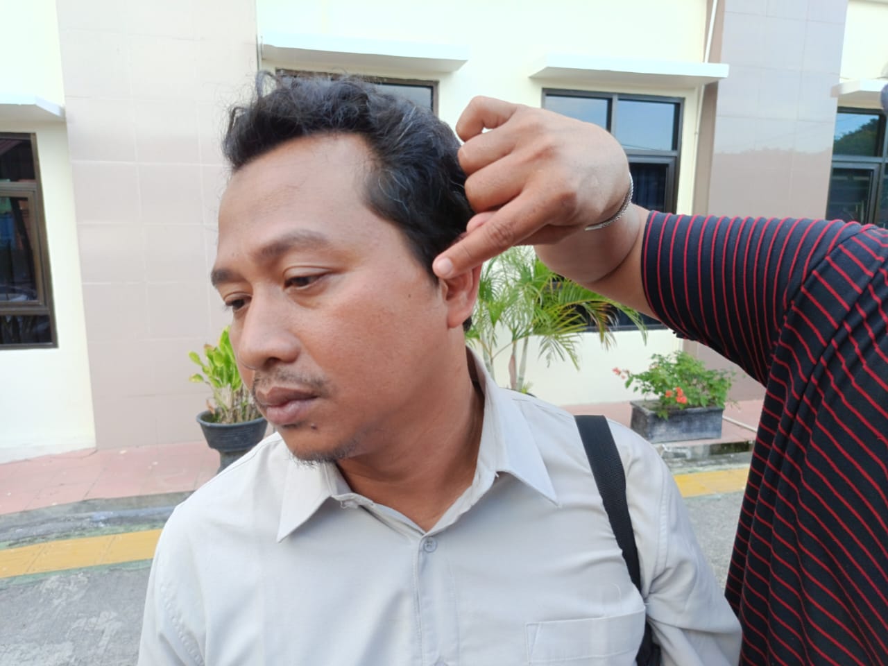 Moeso Novianto menunjukkan bagian wajahnya yang mengalami lebam. (Istimewa)