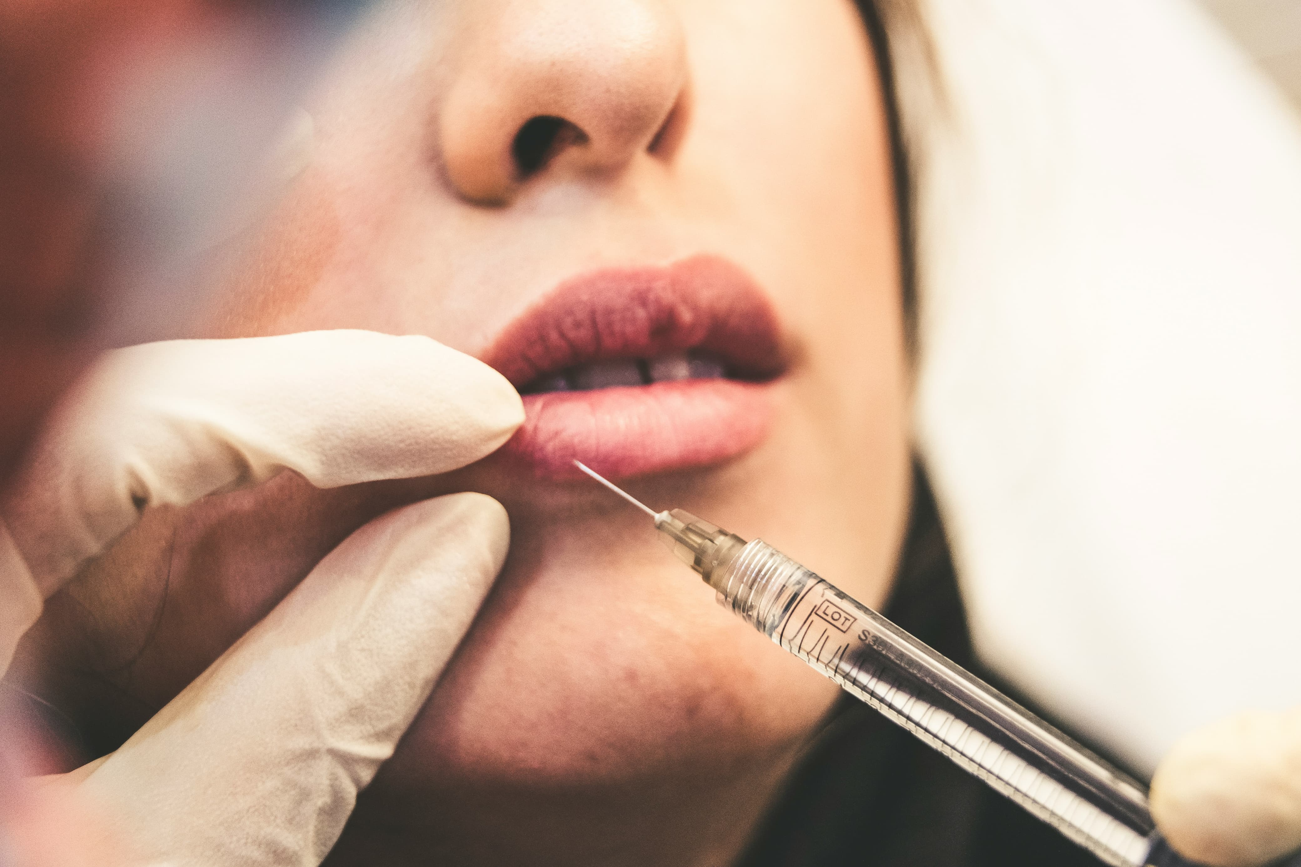 PENAMPILAN: Filler bibir makin ramai.