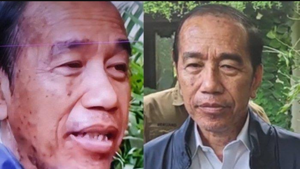 Presiden ke-7 Indonesia dikabarkan sudah mengalami alergi kulit sepulang dari Vatikan. (Foto: tangkapan layar)