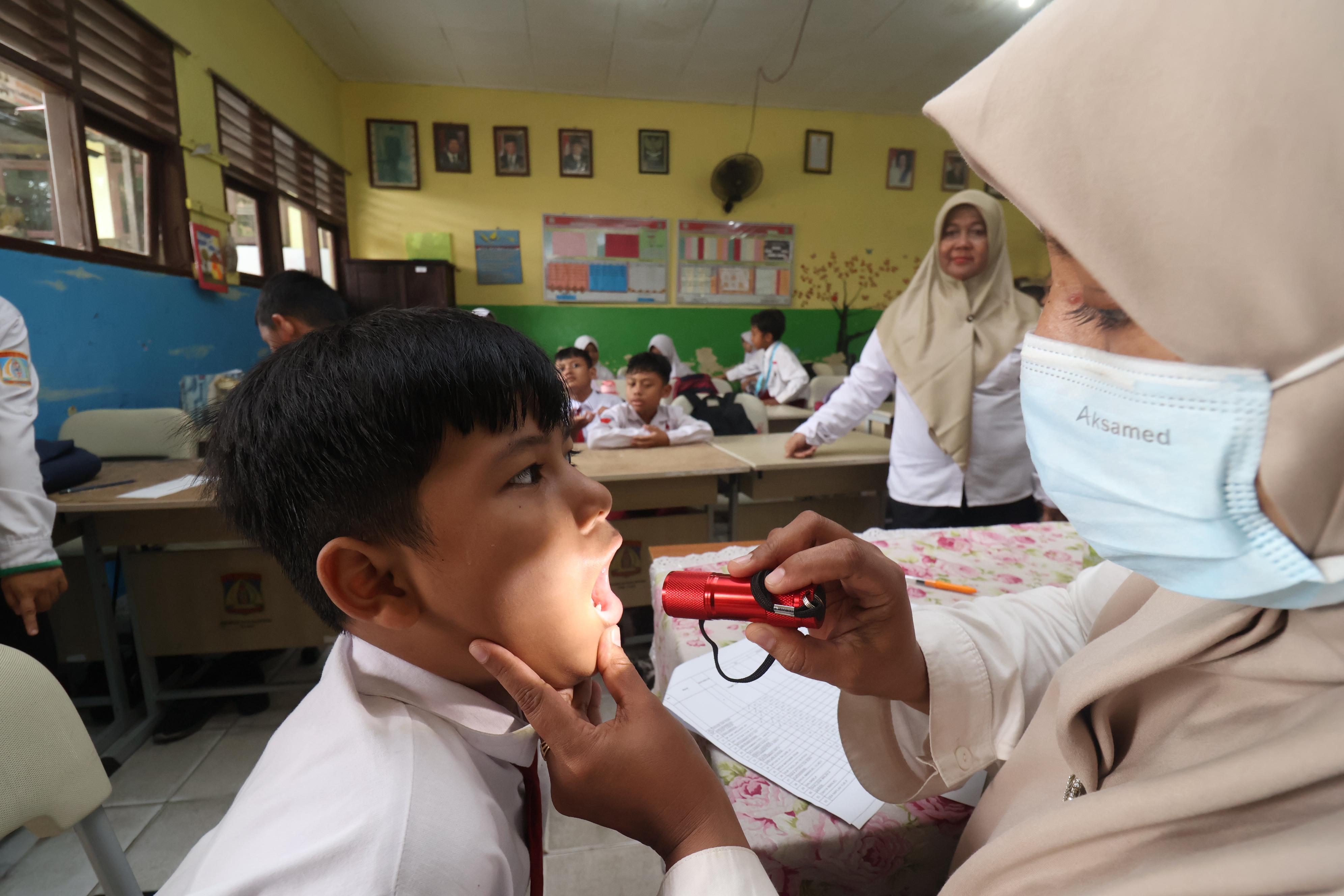 PROSEHAT: CKG memuat pemeriksaan gigi bagi siswa SD. Sehingga lebih lengkap dari penjaringan kesehatan tahun-tahun sebelumnya.