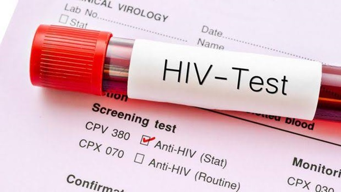 Berani tes HIV sebagai upaya melawan.