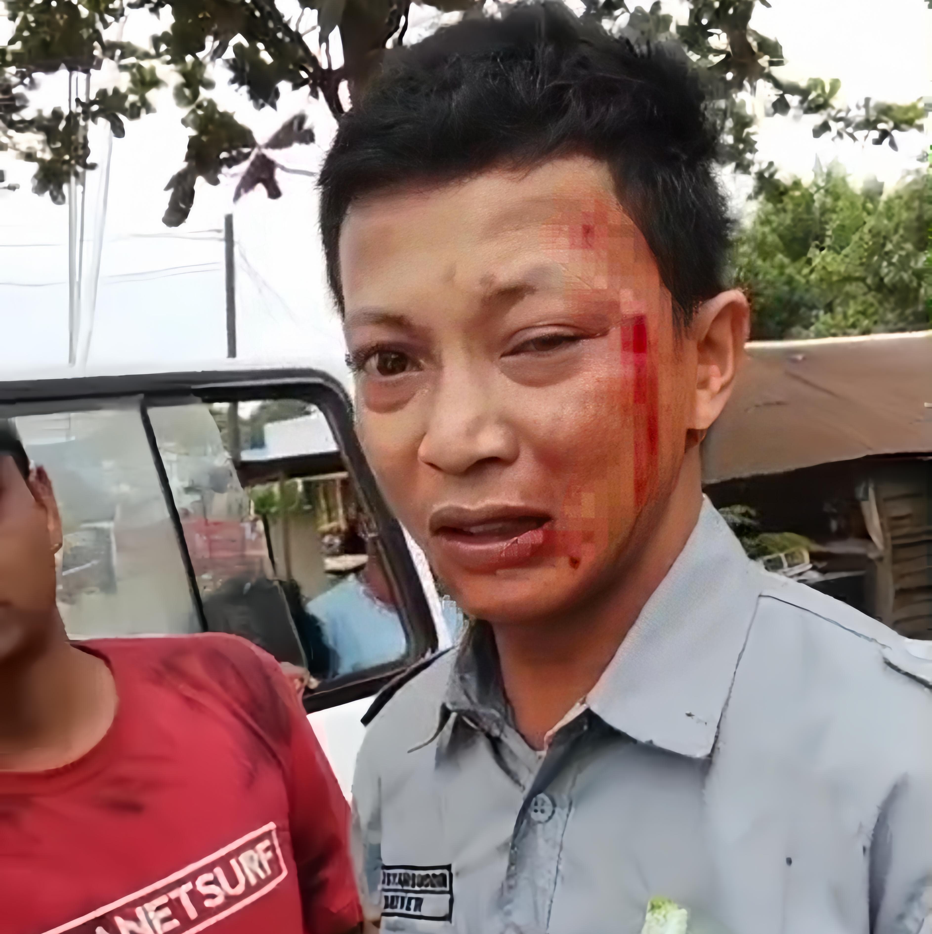 KEKERASAN: Sopir ambulans korban pengeroyokan mengalami luka di bagian wajah usai dianiaya dua pria saat mengantar pasien rujukan di Bengalon, Kutai Timur, Selasa (6/1).