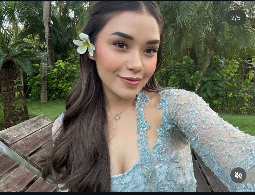 Selebgram Lula Lahfah meninggal dunia.