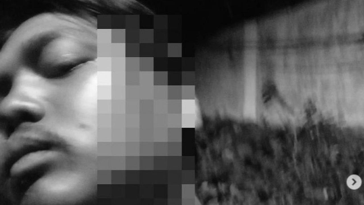 UNGGAHAN: Hasan mengunggah lukanya di media sosial yang kemudian jadi viral.