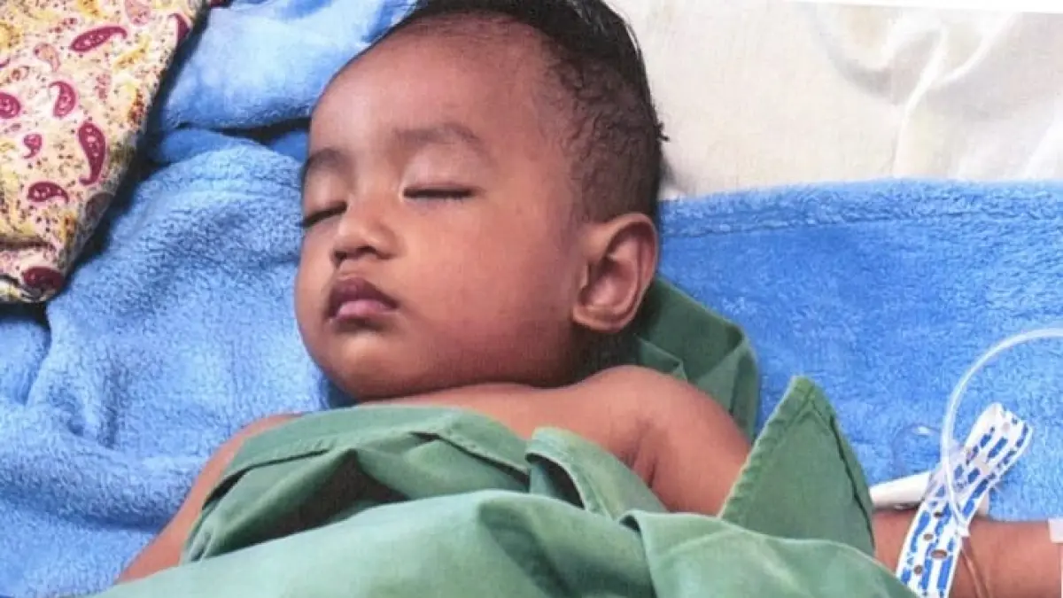 Muhammad Reyhan Pratama, bayi berusia 9 bulan asal Balikpapan usai menjalani operasi UDT. (IST)