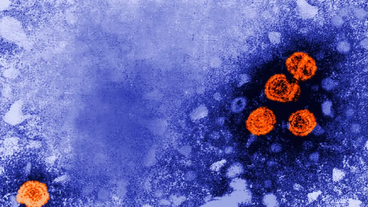VIRUS: Gambar mikroskop elektron 1981 memperlihatkan partikel virus Hepatitis B.(AP)