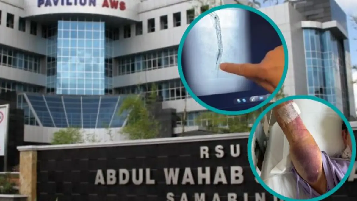 RSUD AWS Samarinda kini tengah berkoordinasi intensif dengan Dinkes Kaltim guna mengevaluasi menyeluruh prosedur bedah, imbas somasi dari keluarga pasien.