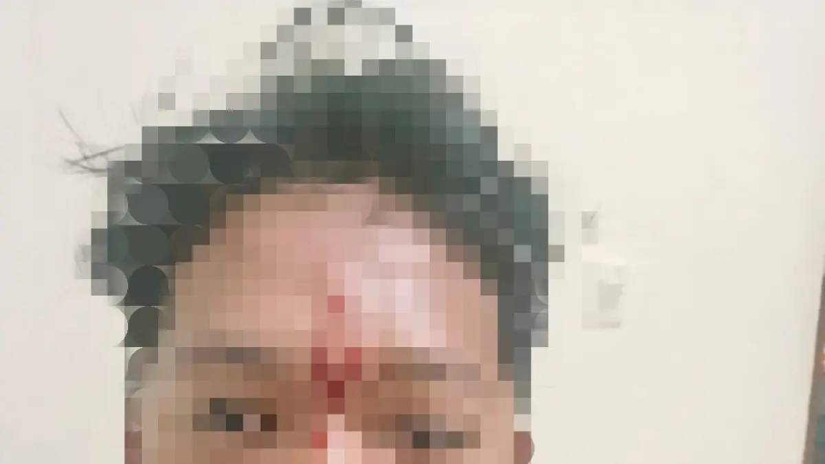 Korban MA

&nbsp;