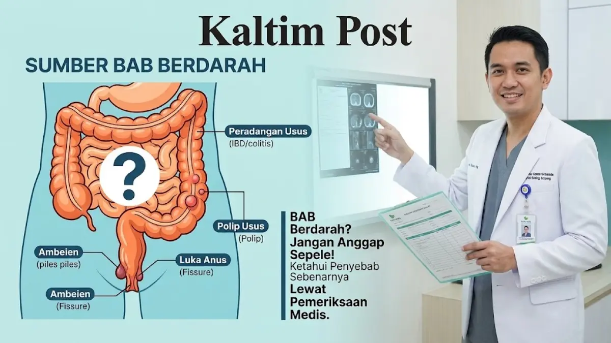 Ilustrasi sumber BAB berdarah tidak mesti ambeien.(generate ai)
