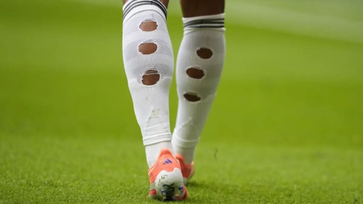 Kaos kaki bolong-bolong Jude Bellingham (Foto: Europa Press Sports)