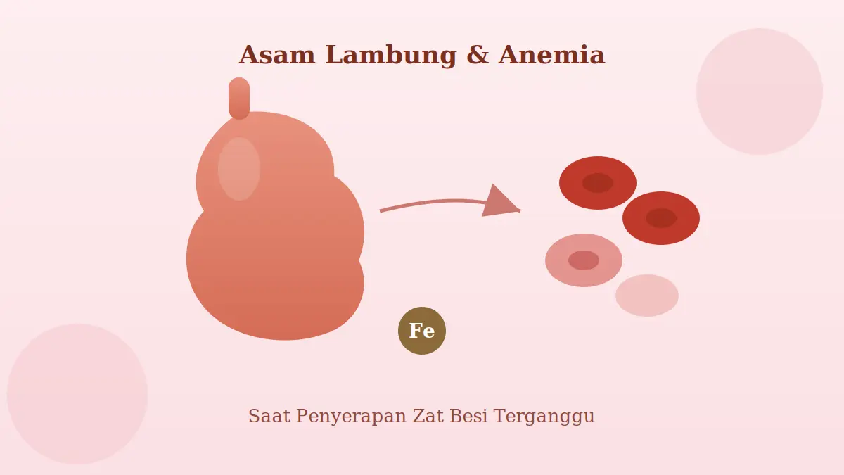 Ilustrasi kaitan antara gangguan asam lambung dan risiko anemia — penyerapan zat besi yang terganggu dapat berujung pada kekurangan sel darah merah.