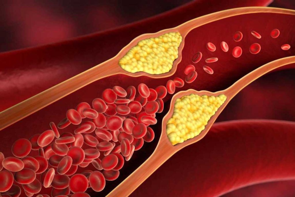 Ilustrasi kolesterol.