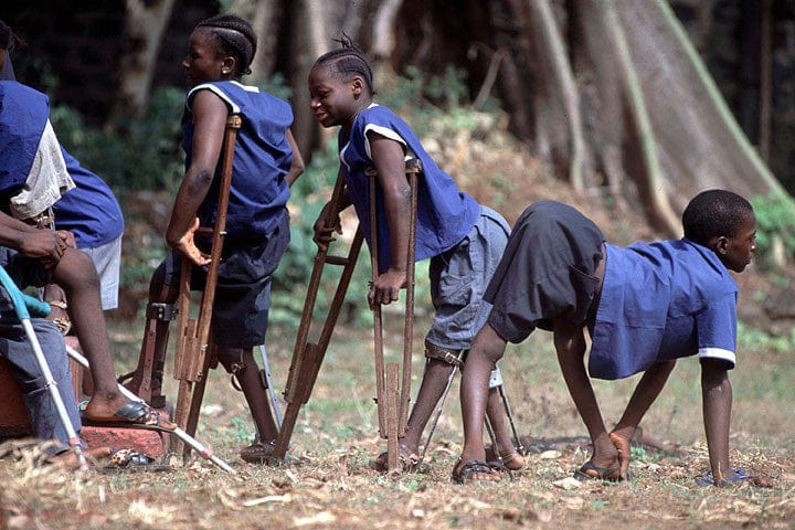Dua kasus baru polio di Sindh, Pakistan, tingkatkan kekhawatiran global atas upaya pemberantasan penyakit menular mematikan ini. (foto: Imunnize)