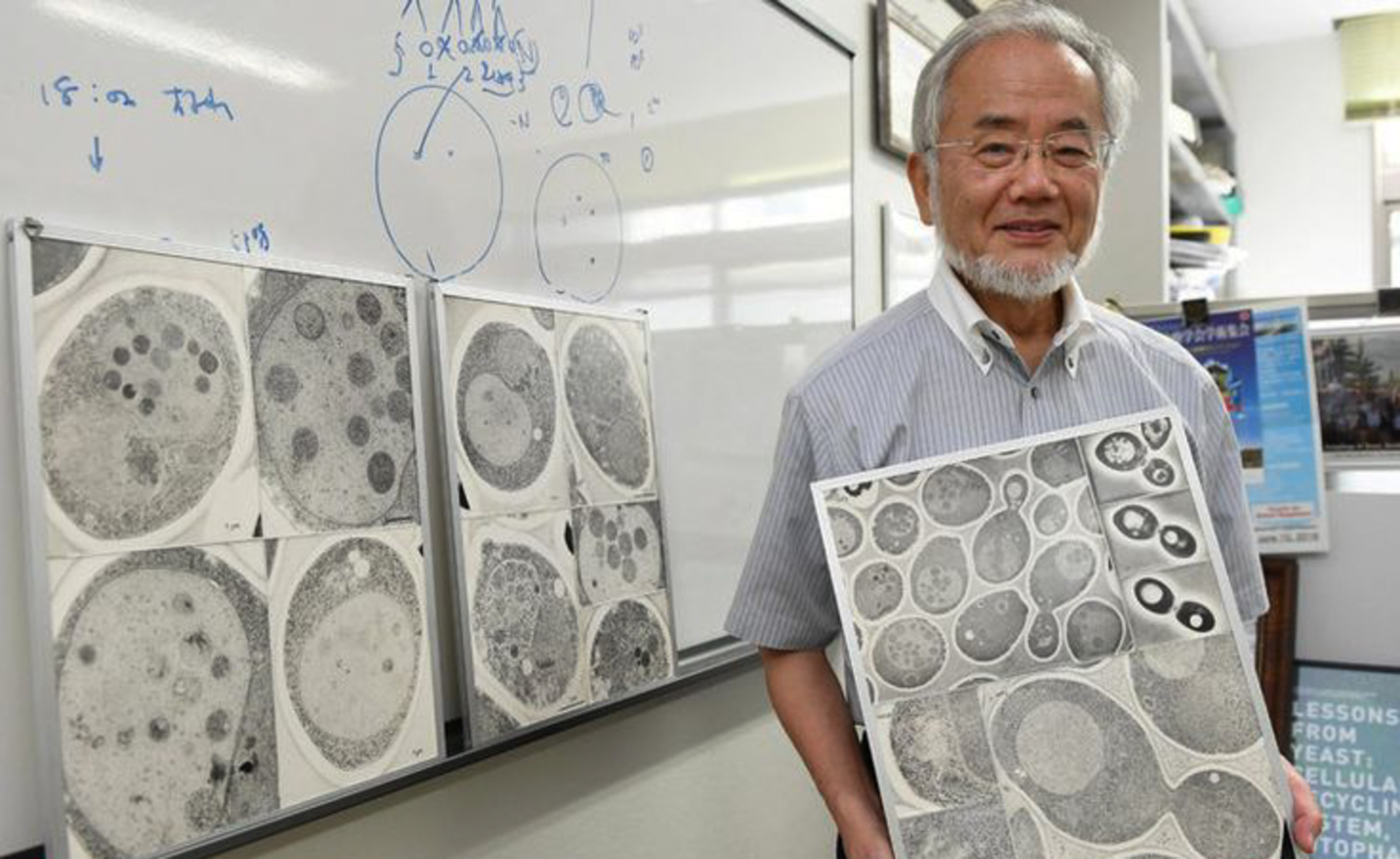 Mengenal Proses Autofagi Temuan Ilmuwan Jepang, Yoshinori Ohsumi. (Foto: Pinterest).
