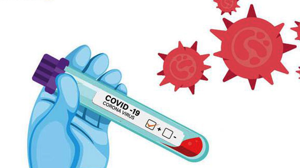 Ilustrasi hasil uji swab. (ist)