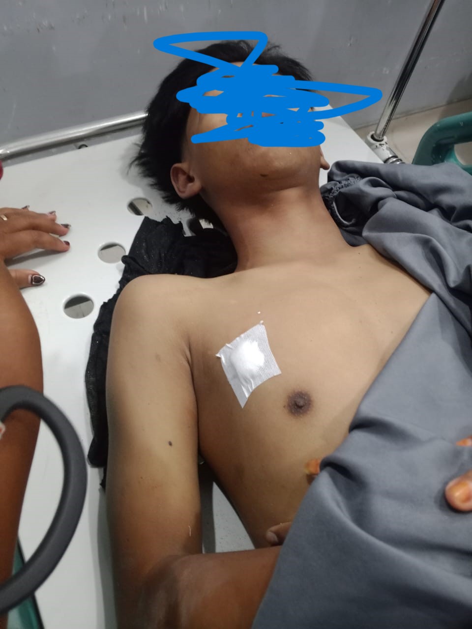 TEWAS: Pelajar SMP  tewas saat dilarikan ke rumah sakit usai kena panah beracun, Sabtu (19/4/2024) malam. ISTIMEWA/SUMUT POS